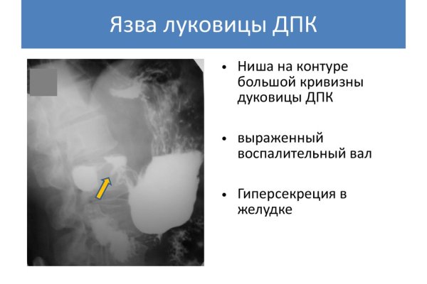 Ссылка на кракен 11